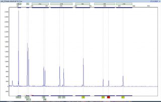  تست تشخیصی QF PCR