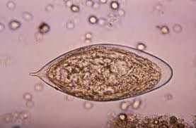 تخم شیستوزوما هماتوبیوم در رسوب ادرار